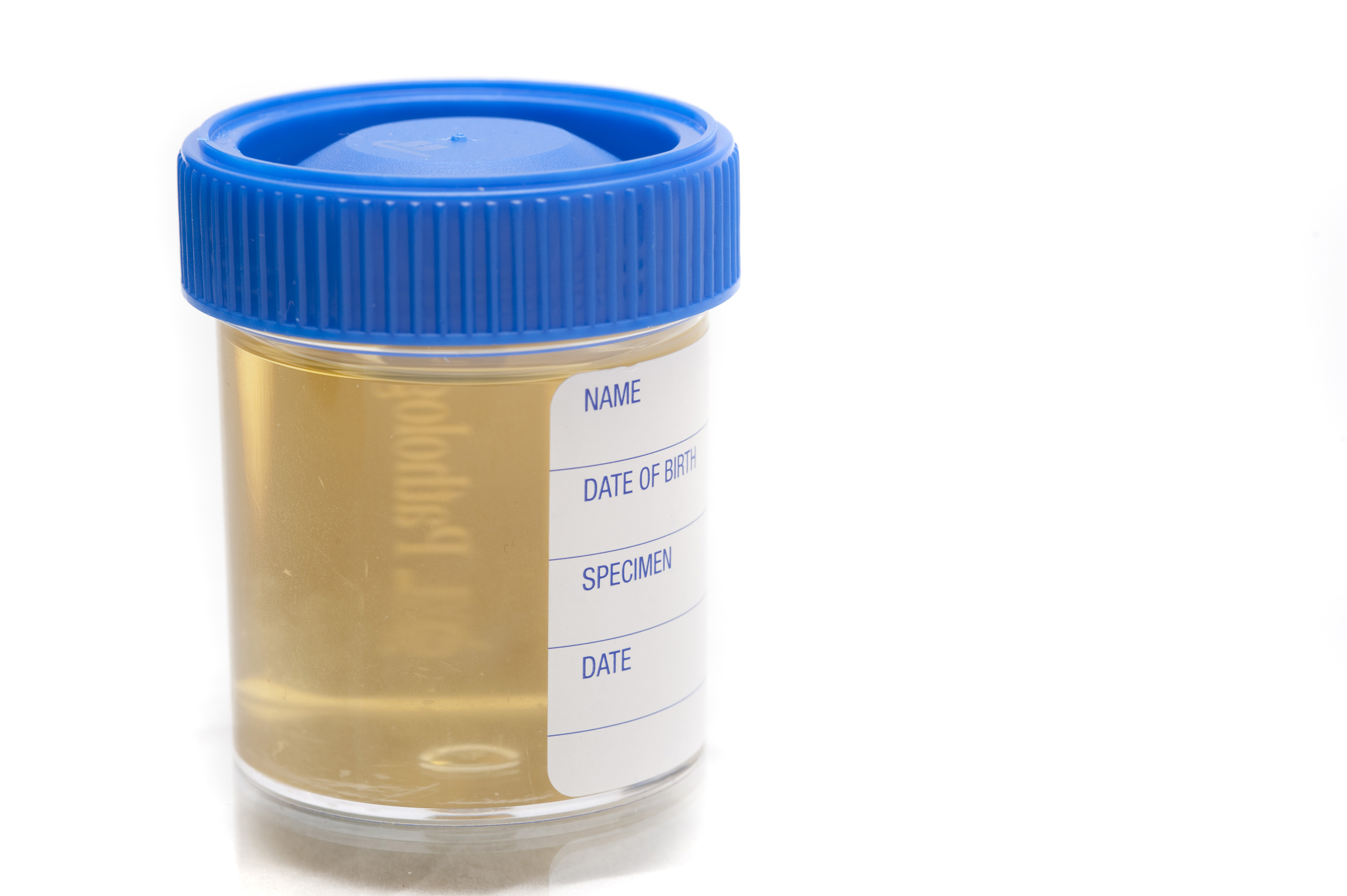 urine sample jar2796 Stockarch Free Stock Photo Archive
