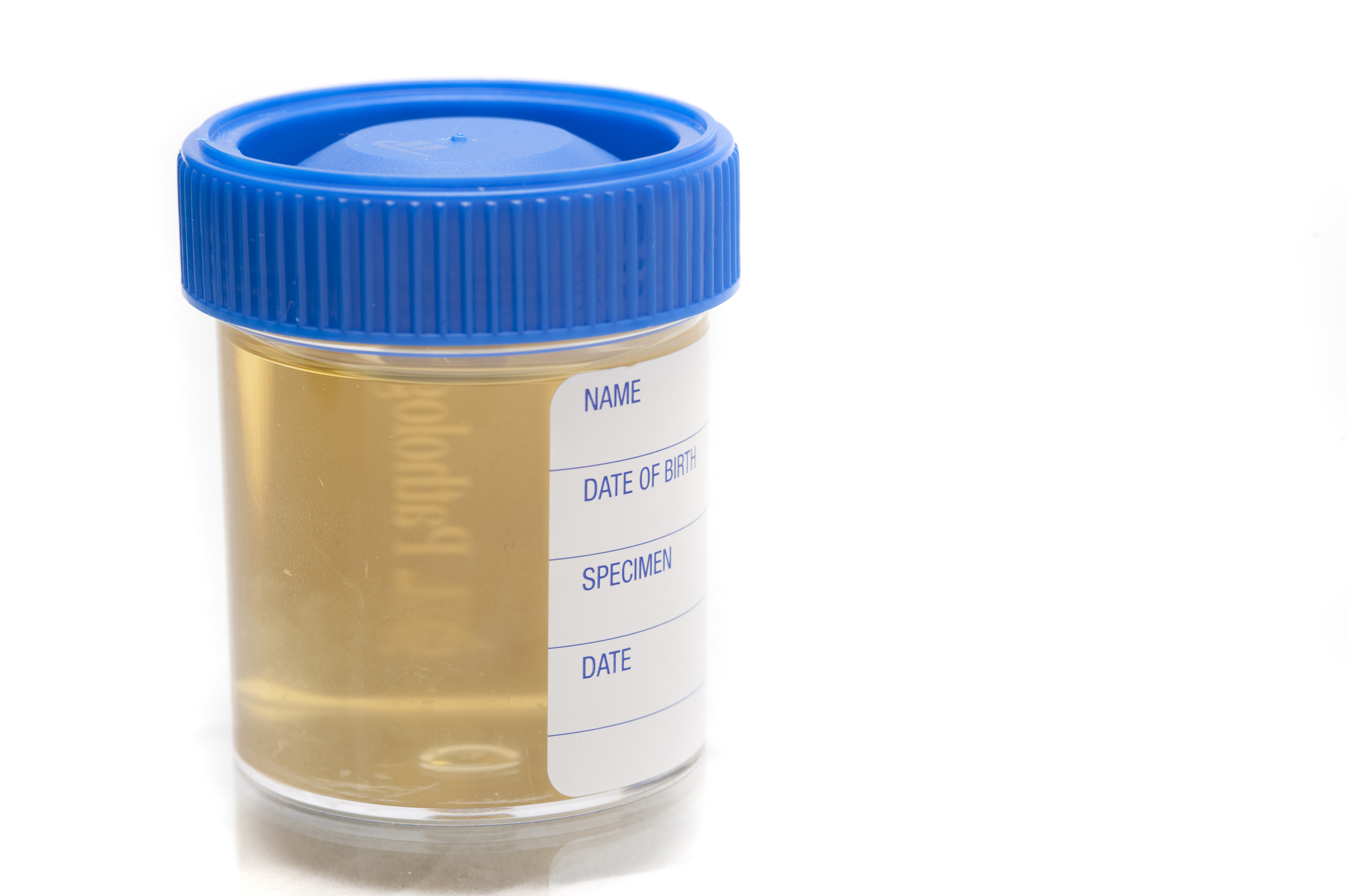 normal-urine-re-test-report